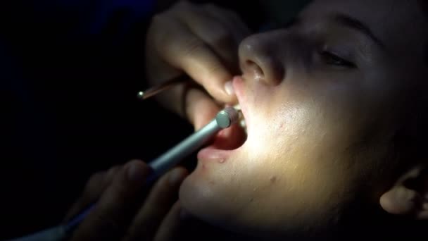 Cirugía Oral Quirófano Oscuro Lámparas Luz Cirugía — Vídeo de stock