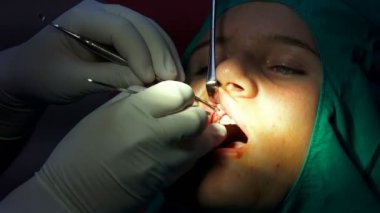 Apicactomy kist remaval cerrahi operasyon sırasında genç yüzü