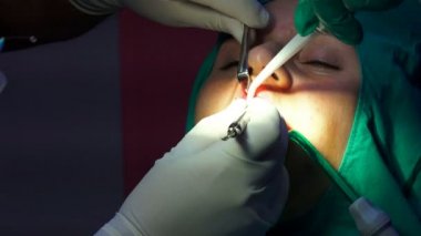 Diş, dişeti, ağız cerrahisi, apicectomia karanlık operasyon odasında kız