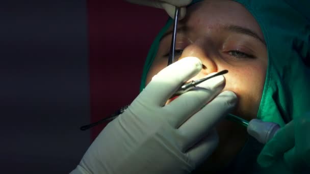 Cirurgia Dentária Oral Ponto Corte Operação Remoção Cisto Apicactomia Dente — Vídeo de Stock