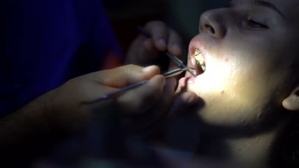 女の子 Endodonic の中に歯科医で歯のシャネルのアプリケーションを充填 — ストック動画