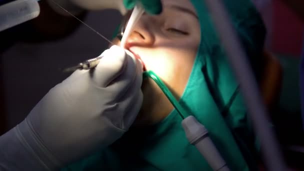 口腔外科手術 Apicectomia 暗い操作室 — ストック動画