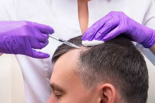 Iniezione Trattamento Perdita Dei Capelli — Foto Stock