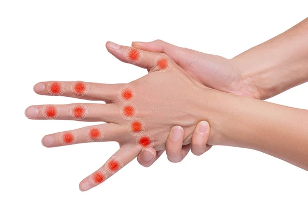 Woman hand with illness, arthritis — Stock Photo, Image