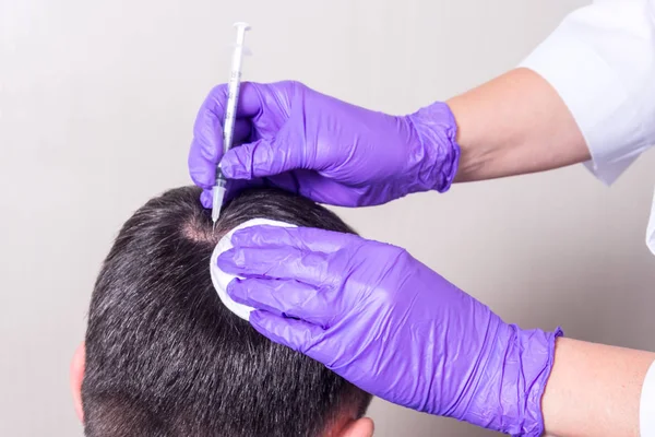 Iniezione, trattamento per la perdita dei capelli — Foto Stock