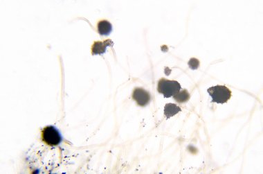 Aspergillus (kalıp mikroskop fotoğraf)