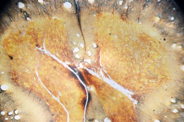 Mikroskop fotoğraf. Spinal kord, kesit.