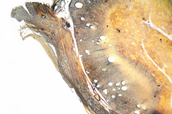 Mikroskop fotoğraf. Spinal kord, kesit.