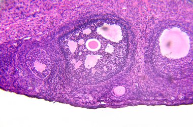 micrograph of ovary showing primordial, primary and secondary follicles isolated on white background. clipart