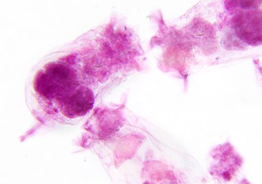 Mikroskopi fotoğraf. Su zooplancton Rotifera