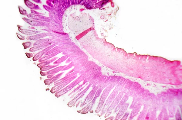 Микроскопическая Фотография Сечение Тонкого Кишечника — стоковое фото