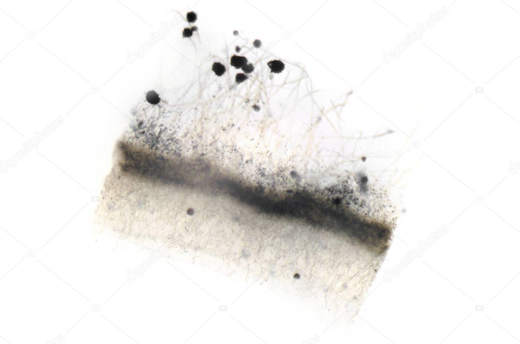 Microscope photography of Aspergillus (mold)