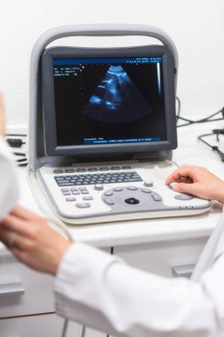 Ultrason tarayıcısı bir doktorun elinde. Tanısal Sonografi kliniği. 