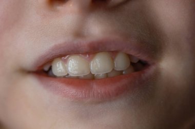 Beyaz dişli 9 yaşındaki bir kızın portresi.