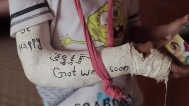 Kathmandu, Nepal - 27 November 2019: Broken hand of a brown Indian Nepali teenager in plaster with inscriptions marker with words of support. The boy is spinning some kind of game in his hands. Close — Stock Video