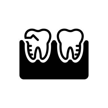 molar siluet