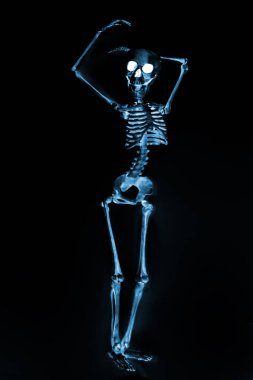 Röntgen makinesinden görünen aptal dans iskeletleri.