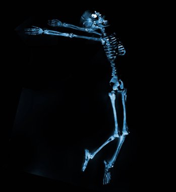 Röntgen makinesinden görünen aptal dans iskeletleri.
