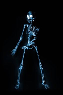 Röntgen makinesinden görünen aptal dans iskeletleri.