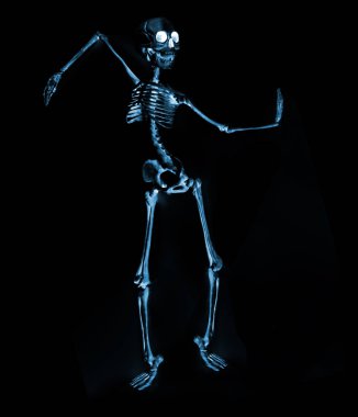 Röntgen makinesinden görünen aptal dans iskeletleri.