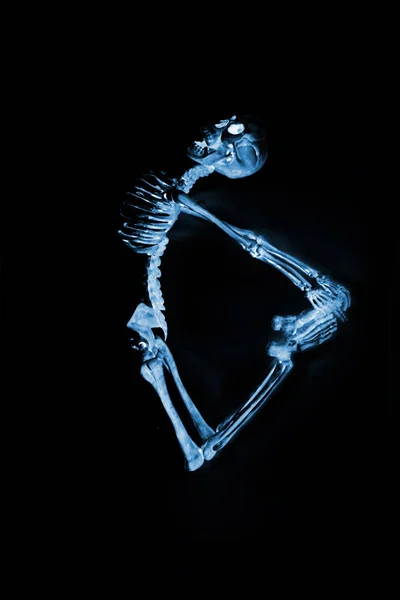 Silly Танцювальні Скелети Видно Через Рентгенівський Апарат — стокове фото
