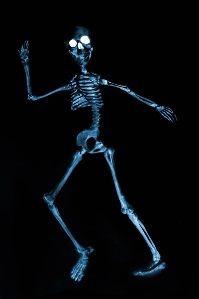 Gekke Dansende Skeletten Gezien Door Een Röntgenapparaat — Stockfoto