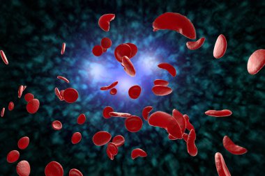 Sickle Cell Anemia 3D Illustration clipart