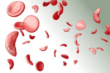 Sickle Cell Anemia 3D Illustration clipart