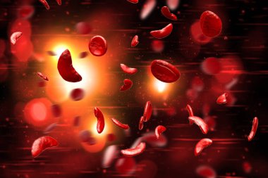 Sickle cell anemia disease (SCD) blood cells 3D illustration clipart