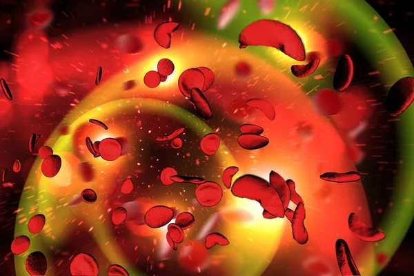 Ілюстрація Клітинної Анемії Серповидноклітинних Захворювань Scd — стокове фото