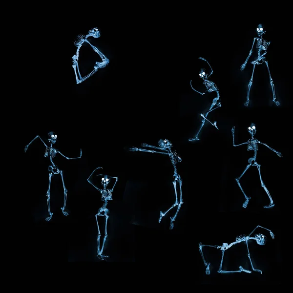 Esqueletos Dançando Tolos Como Visto Através Uma Máquina Raios — Fotografia de Stock