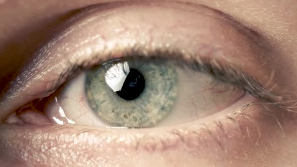 Macro della congiuntivite occhio rosso . — Video Stock