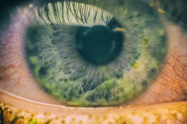 close up açık kırmızı ve tahriş olmuş insan gözü