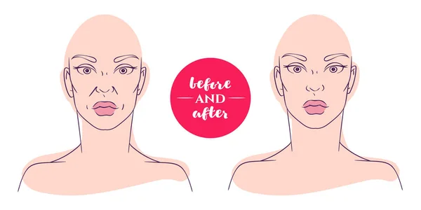Kozmetik Kusurları Ile Önce Sonra Bir Kadın Portresi Plastik Cerrahi Vektör Grafikler
