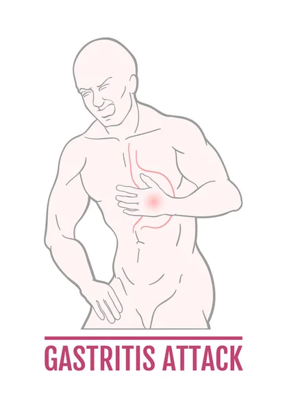 Ilustración Médica Del Dolor Estómago Seres Humanos Ataque Gastritis Esquema — Vector de stock