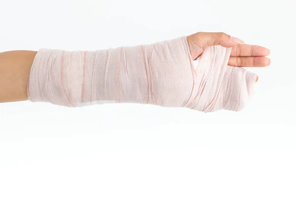 Broken arm left hand of a woman with plaster cast studio photographed on a white background.