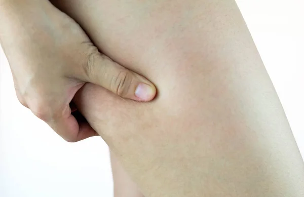 Pernas Femininas Coxas Com Celulite Problema Pele Cuidados Com Corpo — Fotografia de Stock