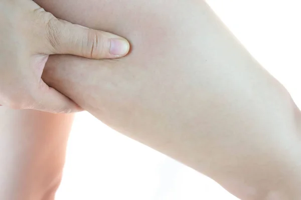 Piernas Femeninas Muslos Con Celulitis Problema Piel Cuidado Corporal Sobrepeso —  Fotos de Stock