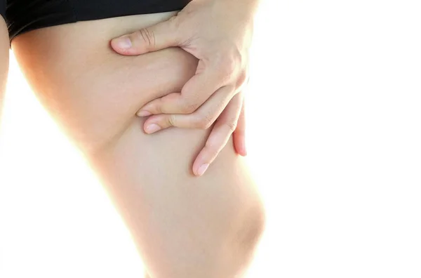 Бедра Женских Ног Целлюлитом Проблема Кожи Уход Телом Избыточный Вес — стоковое фото