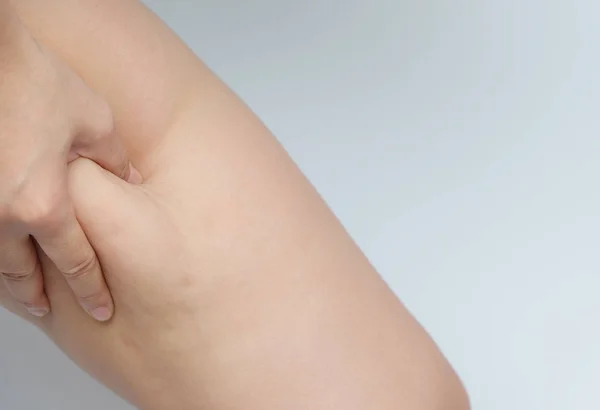 Γυναίκα Χέρι Πιάνει Την Κοιλιά Λίπος Σώματος Κοιλιά Διαβητική Παράγοντας — Φωτογραφία Αρχείου