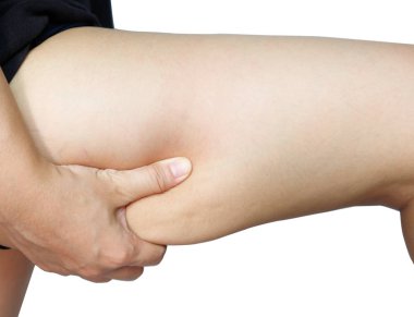 Beyaz arka plan üzerinde izole selülit kadın bacağı uyluk. Cilt sorunu, vücut bakımı, şişmanlık ve diyet kavramı, diyabetik risk facto