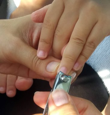 Anne Bebek tırnak tırnak makası ile almak banyodan sonra kesilmiş..