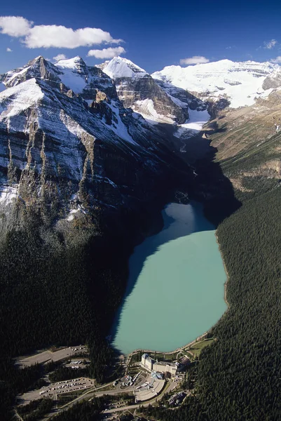 Vista Aérea Lago Louise Nas Montanhas Parque Nacional Banff Alberta — Fotografia de Stock