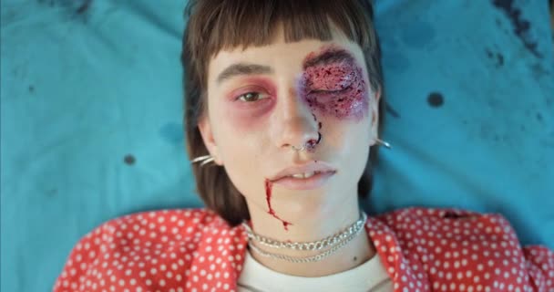 Top view of millennial girl with blood and head wound riding to hospital. Female teenager lying on medical transportation cart in ambulance. Concept of healthcare. — Stock Video