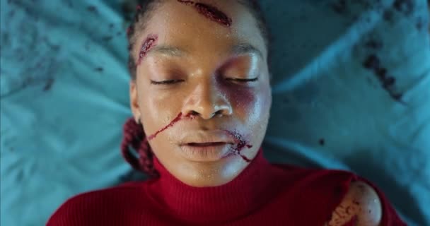 Vista superior da menina afro-americana com sangue e ferida na cabeça no hospital. Jovem deitada no carrinho de transporte médico em ambulância. Conceito de cuidados de saúde . — Vídeo de Stock