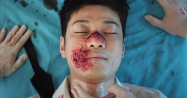Hastanenin sedyesinde yatan kan ve kafa travmaları olan Asyalı bir adam görülüyor. Sağlık görevlileri ambulansta yaralanan genç adama kalp atış hızını ölçüyorlar..