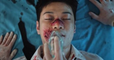 Doktorların elleri yaralı bir adam takarken oksijen solunum maskesi takıyor. Bilinci yerinde olmayan, kafa travması geçiren Asyalı bir adam hastaneye giderken tıbbi nakliye sedyesinde yatıyor..