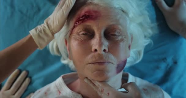 Draufsicht einer alten Dame mit Blut- und Kopfverletzungen, die auf einer Krankenhaustrage stirbt. Sanitäter reichen reife Frau mit Verletzungen im Rettungswagen Herzfrequenzmessung. — Stockvideo