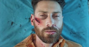 Kan ve kafa travması geçiren, bilincini kaybeden sakallı adama yakından bakın. 40 'lı yaşlarda ağır yaralı bir adam ambulansla hastaneye kaldırılırken sedyede yatıyor..