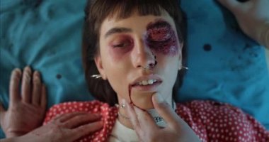 Kan ve kafa travması geçiren genç hippi kızın bilincini kaybetmesine yakından bakın. Millennial 'da ciddi yaralanmış bir kadın ambulansla hastaneye kaldırılırken sedyede yatıyor..